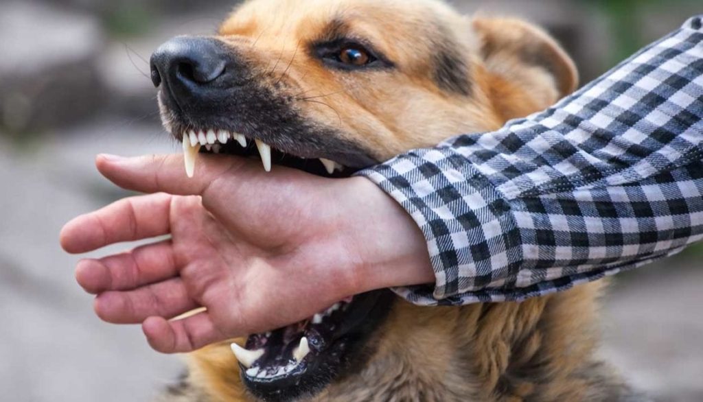 Handle Dog Bites